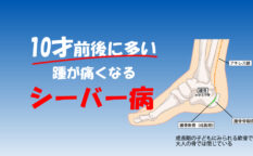 小学生で「踵が痛い」は”シーバー病”かも