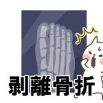 ジュニアユース　剥離骨折