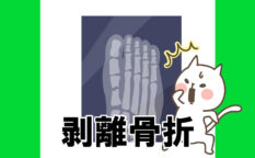 ジュニアユース　剥離骨折