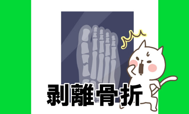 ジュニアユース　剥離骨折