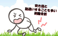 突き指と勘違いすることも多い剥離骨折