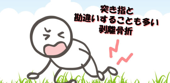 突き指と勘違いすることも多い剥離骨折