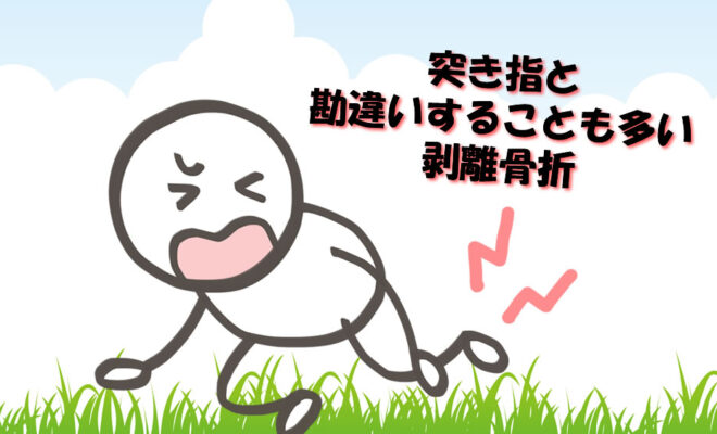 突き指と勘違いすることも多い剥離骨折