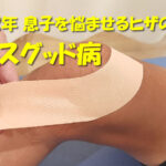 中学2年 息子を悩ませるヒザの痛み　オスグッド病