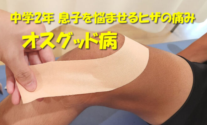 中学2年 息子を悩ませるヒザの痛み　オスグッド病